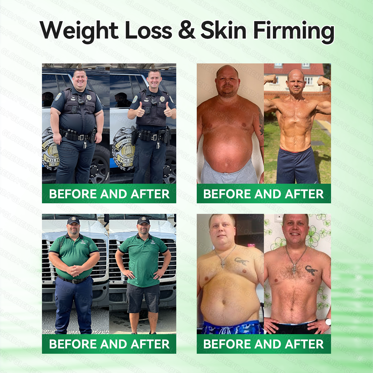 𝑶𝒇𝒇𝒊𝒄𝒊𝒂𝒍 𝑺𝒕𝒐𝒓𝒆  |💯💯𝐂𝐚𝐫𝐞𝐔𝐩𝐥𝐢𝐟𝐭® 𝑴𝒐𝒓𝒊𝒏𝒈𝗮 · 𝗕𝗲𝗿𝗯𝗲𝗿𝙞𝙣𝙚 × 𝙉𝘼𝐃+ 𝟏𝟎-𝐢𝐧-𝟏 𝗔𝗱𝘃𝗮𝗻𝗰𝙚𝙙 𝙉𝙖𝙣𝙤 𝙈𝙞𝙘𝙧𝙤𝙣𝙚𝙚𝐝𝐥𝐞 𝐏𝐚𝐭𝙘𝙝🇺🇸(𝐉𝐮𝐬𝐭 𝐨𝐧𝐜𝐞 𝐚 𝐝𝐚𝐲, 𝐯𝐢𝐬𝐢𝐛𝐥𝐞 𝐜𝐡𝐚𝐧𝐠𝐞𝐬 𝐢𝐧 𝟕 𝐝𝐚𝐲𝐬） ✅ 𝐅𝐨𝐫 𝐨𝐛𝐞𝐬𝐢𝐭𝐲, 🅛🅞🅞🅢🅔 🅢🅚🅘🅝,𝐝𝐢𝐚𝐛𝐞𝐭𝐞𝐬, 𝐬𝐥𝐞𝐞𝐩 𝐚𝐩𝐧𝐞𝐚, 𝐣𝐨𝐢𝐧𝐭 𝐢𝐬𝐬𝐮𝐞𝐬, 𝐚𝐧𝐝 𝐦𝐨𝐫𝐞💯💯